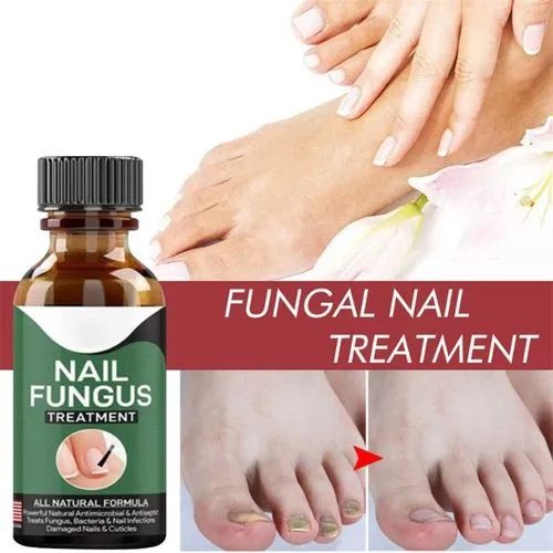 Nail Fungus Removal Gel - Fungal Treatment Serum